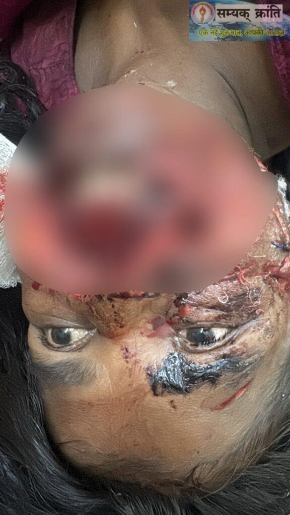 1-5-576x1024 जंगली भालू के हमले में घायल गर्भवती महिला, 108 एम्बुलेंस स्टाफ ने रास्ते में कराया सुरक्षित प्रसव