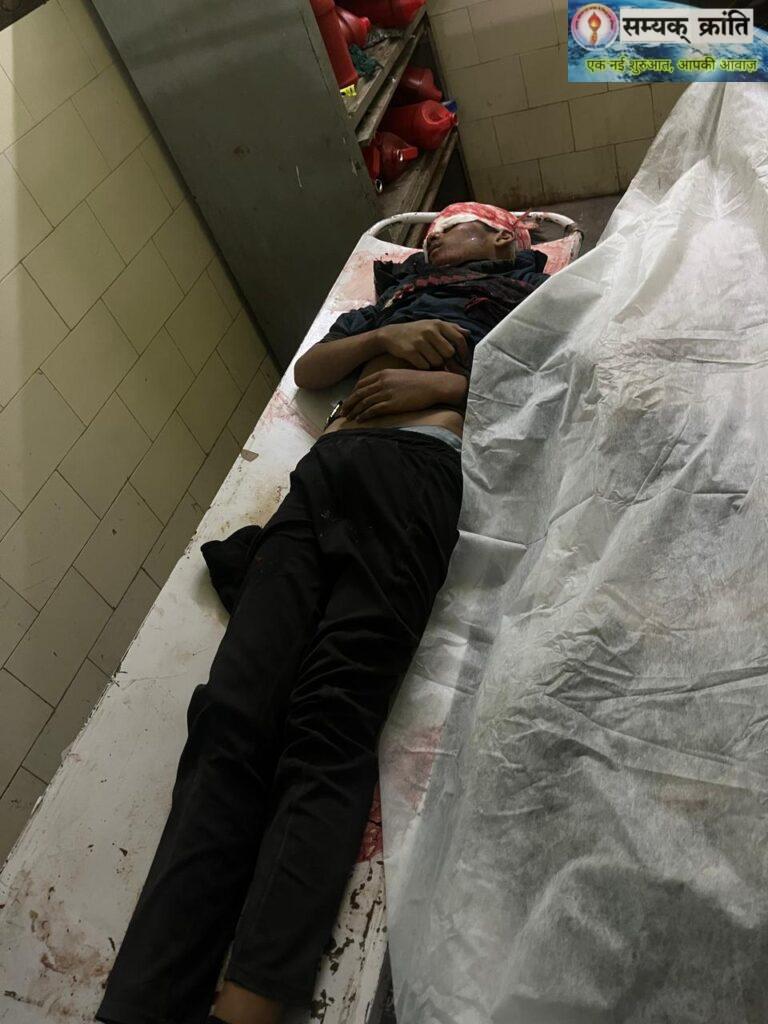 WhatsApp-Image-2026-01-14-at-7.29.34-PM-768x1024 पैलेस रोड हादसे में दो नाबालिगों की मौत, एक युवक गंभीर घायल अज्ञात कार चालक फरार